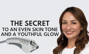 Moxi Laser Treatment